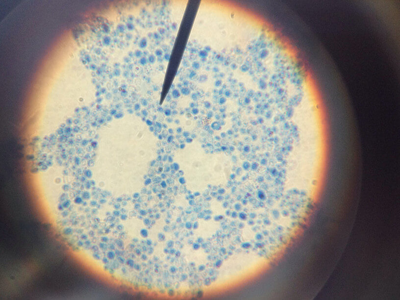 close-up-view-light-blue-pen-shine-round-zoom-lens-pointer-cells-bacteria-microscope_t20_OLgE9E (1)