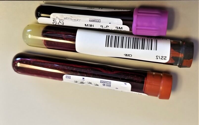 may-18th-is-national-hiv-vaccine-awareness-day-to-recognize-and-to-thank-all-of-the-thousands-of_t20_R6GXBm (1)